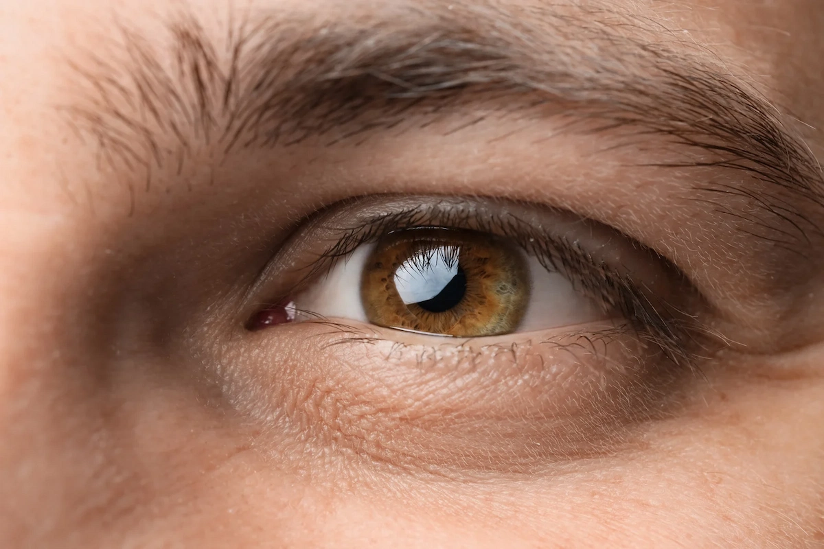 Male Blepharoplasty Dr Mark Plastic Surgery