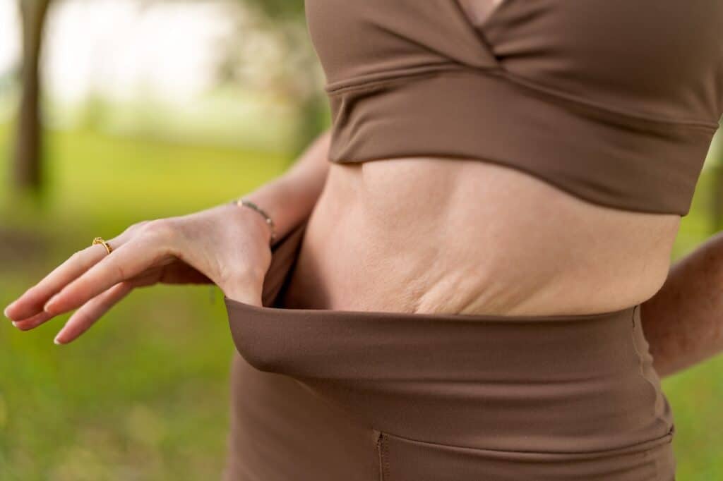 Reverse Tummy Tuck Results