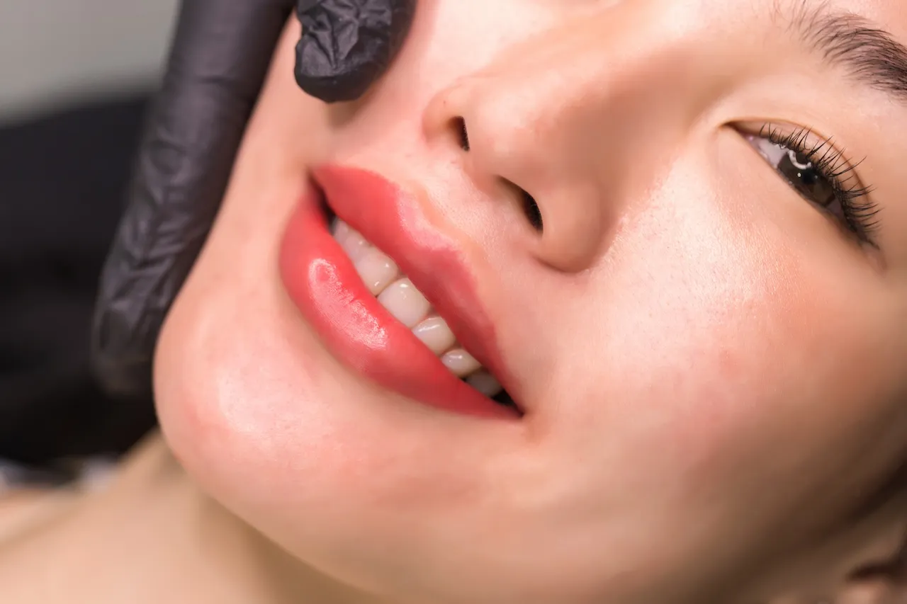 Silicone Lip Removal AZ