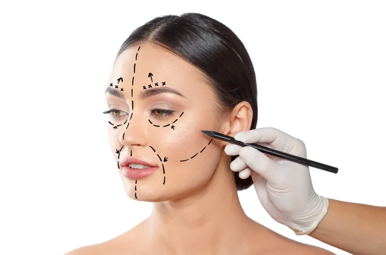 surgeon marking woman face for surgery