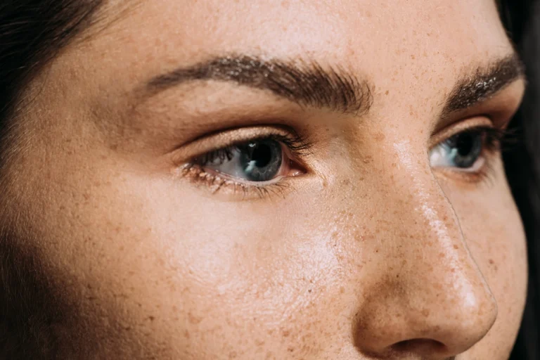 beautiful girl with freckles