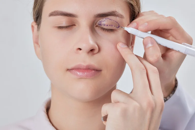 eyelid surgery preparation