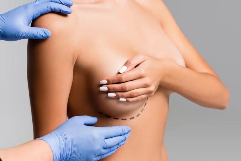pre-breast surgery