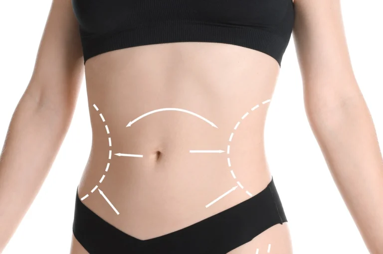 contouring marks on female body