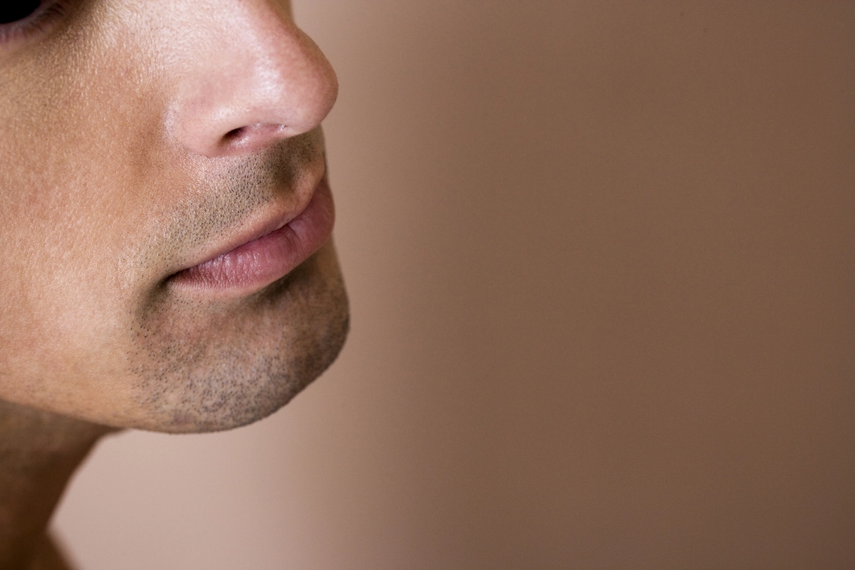 nasal valve repair recovery